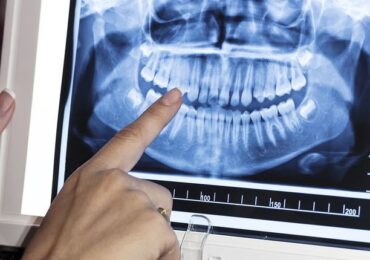 Тренінг з оволодіння практичними навичками «Рентгенологічні дослідження на стоматологічному прийомі. Методики оцінювання результатів» (25 балів БПР)